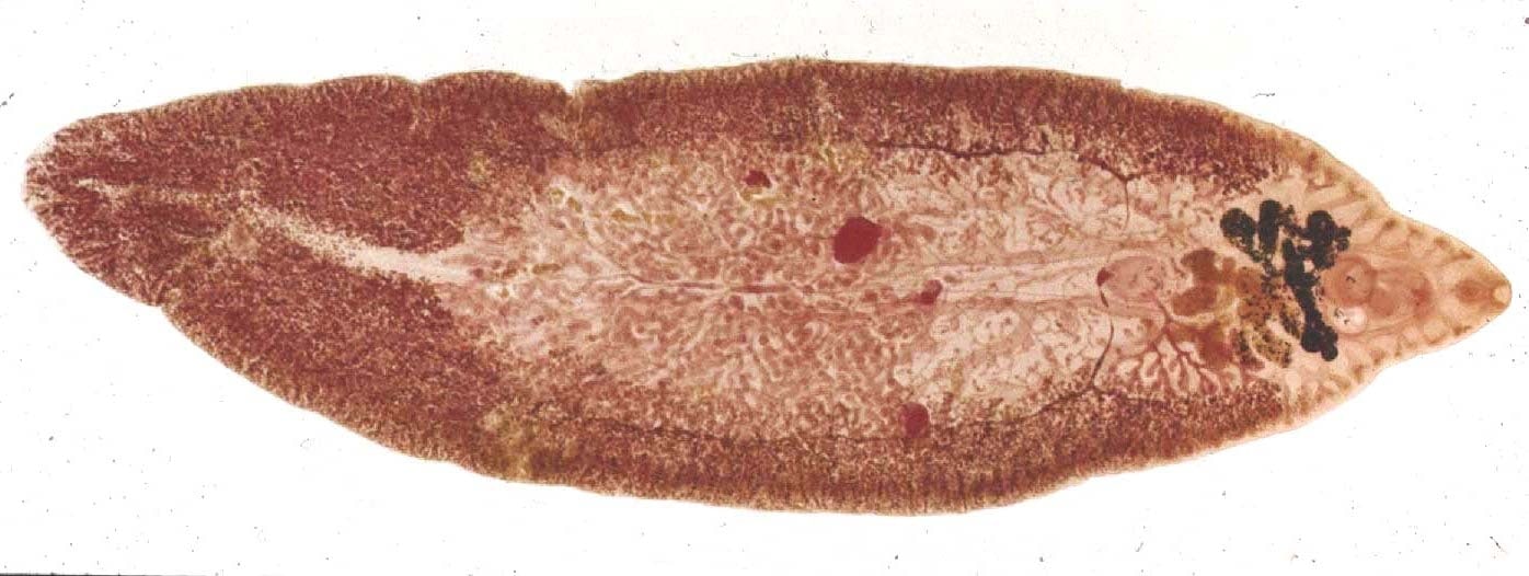 fasciolopsis buski